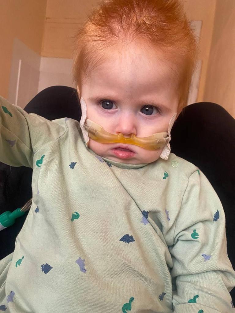 Kleinkind mit roten Haaren und Sauerstoffzufuhr durch die Nase